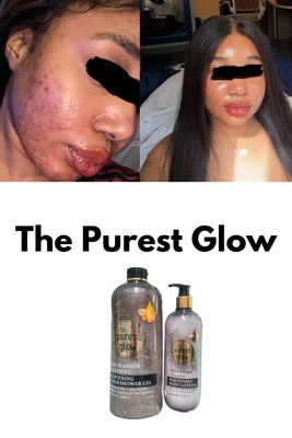 The Purest  Glow Niacinamide And Ginseng Lightening Scrub Shower Gel And Lotion