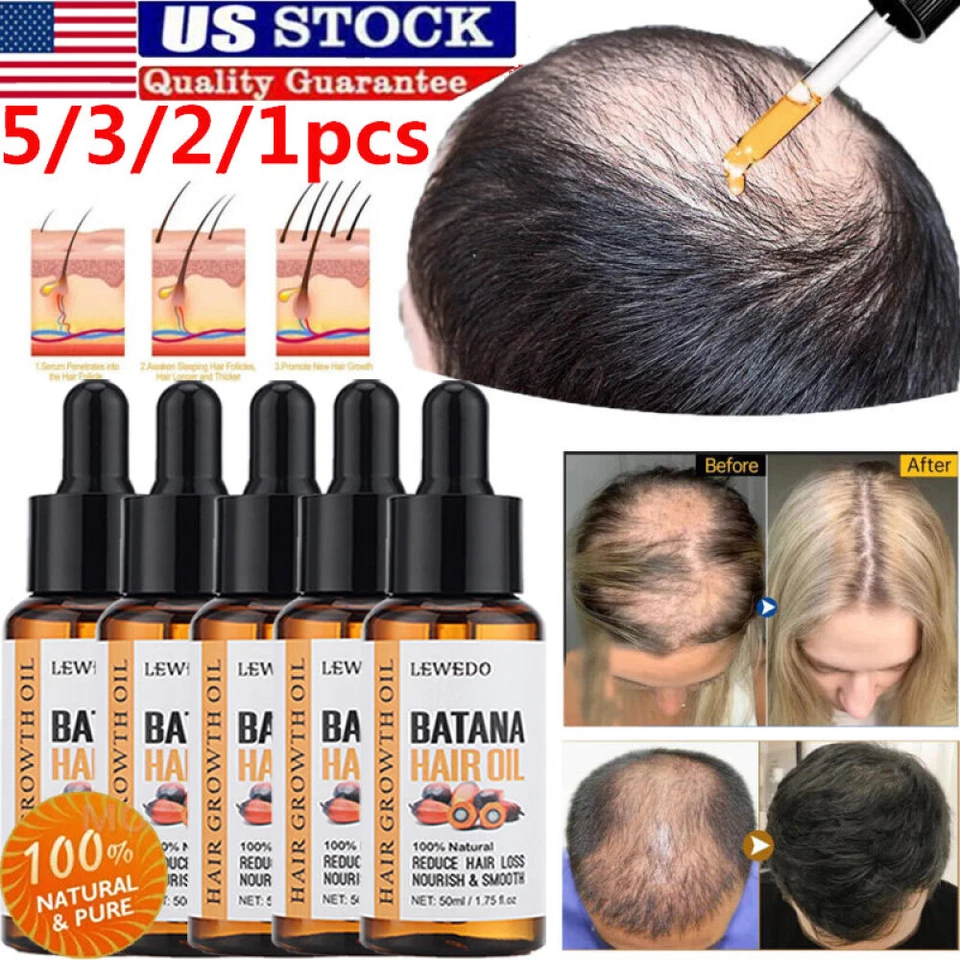 Aceite de Batana Natural 5/3X para el Crecimiento del Cabello, Aceite de Batana Orgánico, Reparar Cabello Dañado Foto 2 de 4