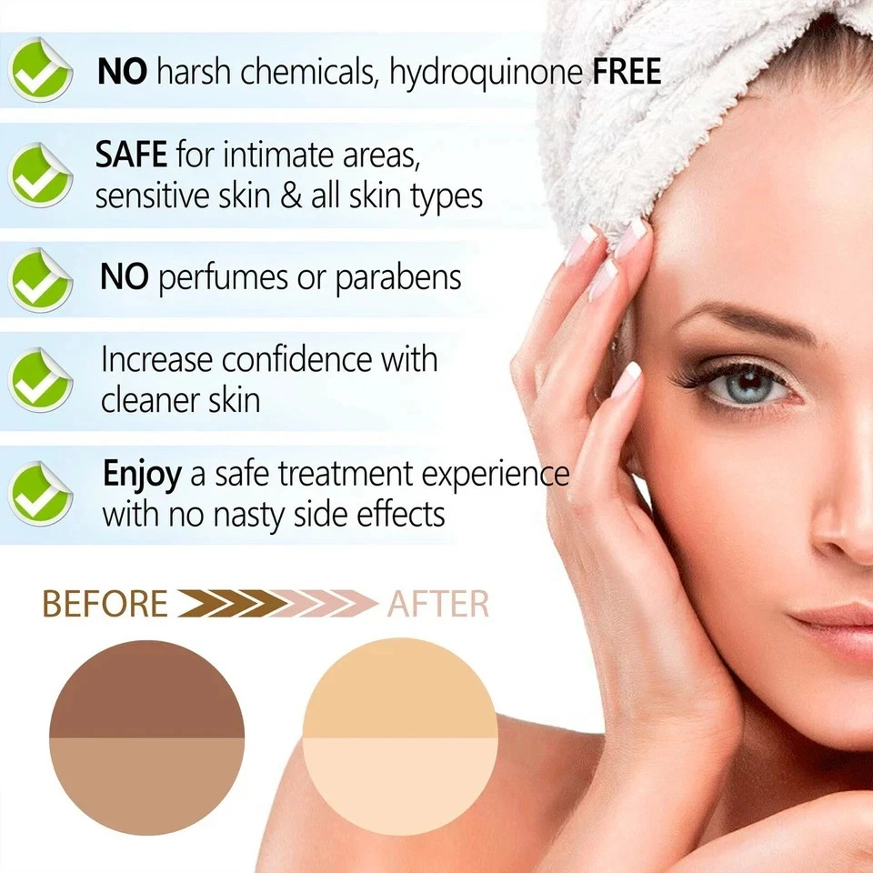 KOJIC ACID Skin Whitening Lightening Brightening Serum Bleaching/Spot Fade Cream - Image 4 of 4