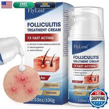 FLYLEAF Folliculitis Treatment Cream - 5 Benzoyl Peroxide  Tea - 100g/3.53oz