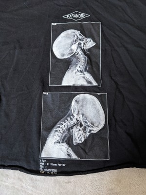 Paramore - Cropped Headbanger X-Ray Doctors Orders T-Shirt - Small
