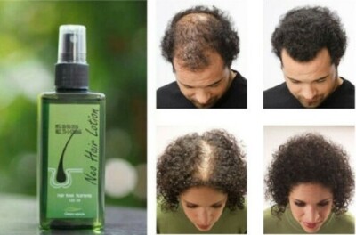 Neo Haarlotion Spray gegen Haarausfall & Nachwachsen Männer & Frauen 120ml 1 Monatsvorrat