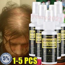 5/3X Minoxidil 5 Hair Growth Serum -Extra Strength Regrowth Serum Spray for Men