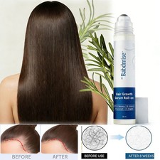 Be Bodywise Hair Growth Serum Roll-On 25ml - 3 Rosemary, Reduces Hair Fall