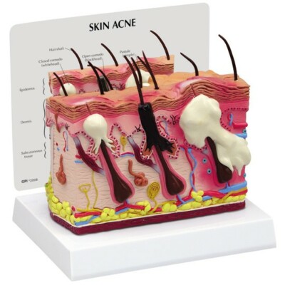 Acne Skin 2-sided Anatomical Model  GPI  LFA #3751 SEE VIDEO Make Us an Offer!