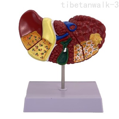 Medical Science Colored Pathology Liver Anatomical Model