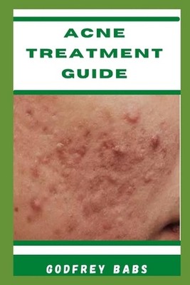 Acne Treatment Guide: Manage acne with ease by Godfrey Babs Paperback Book