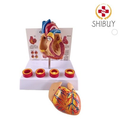 Anatomical Life Size Heart Cardiovascular Anatomy Thrombotic Vascular Model