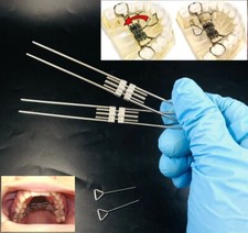 Dental Orthodontic Rapid Maxillary Expansion Screw Palatal Split Hyrax Expander
