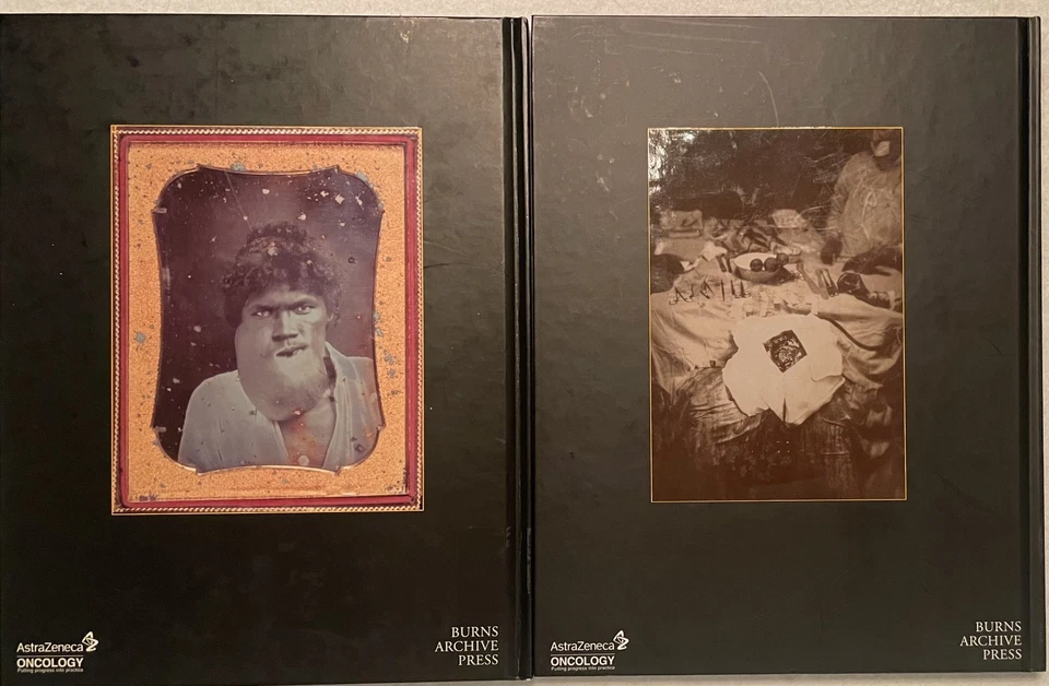 2 Bks ONCOLOGY TUMORS & TREATMENTS. Eras: 1845-75 Aesthesia & 1916-45 Radium GC - Image 2 of 4