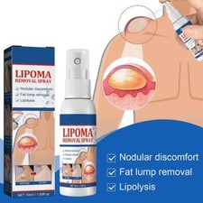 50ml Lipomheilung Reduction Spray, Instant LumpFree Removal SALE Lipoma T2N0