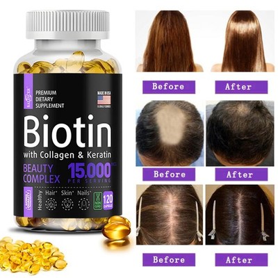 Biotin Capsules - 120 Capsules-5000 mcg Biotin-for Hair, Skin, and Nails - Vegan