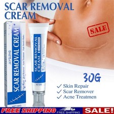 Scar Cream Facial  Body Scar Cream Scar Acne Stretch Mark Removal Ointment 