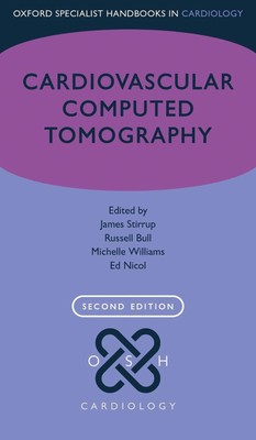 Cardiovascular Computed Tomography by James Stirrup (English) Paperback Book