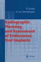 Reinhilde Jacobs (U. A.) | Radiographic Planning And Assessment Of Endosseous...