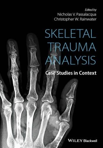 Skeletal Trauma Analysis by Nicholas V. Passalacqua, Christop... - 9781118384220