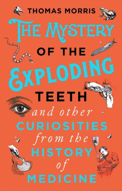 The Mystery of the Exploding Teeth and Other Curiosities from the History of