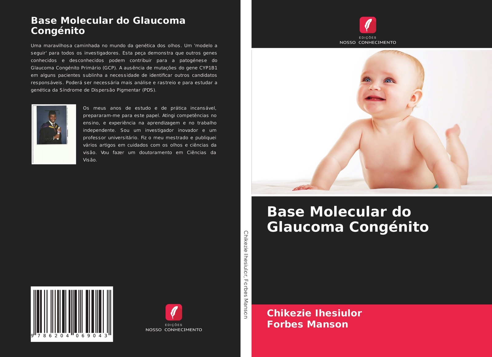 Thumbnail - Base Molecular Do Glaucoma Congénito Chikezie Ihesiulor (u. A.)
