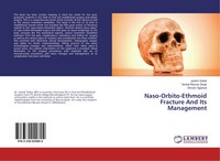 Naso-Orbito-Ethmoid Fracture And Its Management Jyotish Saikia (U. A.) Buch 2017