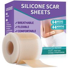 Silicone Scar Sheets, Medical Grade Silicone Scar Tape 1.6" X 120" , Profession
