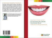 O Carcinoma De CéLulas Escamosas Bucal LaíS Guedes