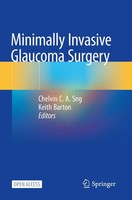 Minimally Invasive Glaucoma Surgery Chelvin C A Sng (U. A.) Taschenbuch Ix 2021
