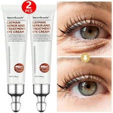 2x Eye Cream Instant Remove Eye Bags Dark Circles Anti Wrinkle Depuffing Firming