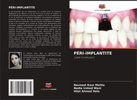 PÉRI-IMPLANTITE Navneet Kour Mehta