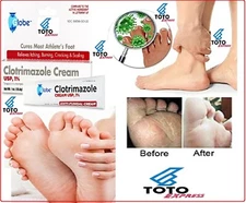 Crema Pomada Crema Pomadas para Los Hongos Hongo Ongos Tratamiento Antihongos ys