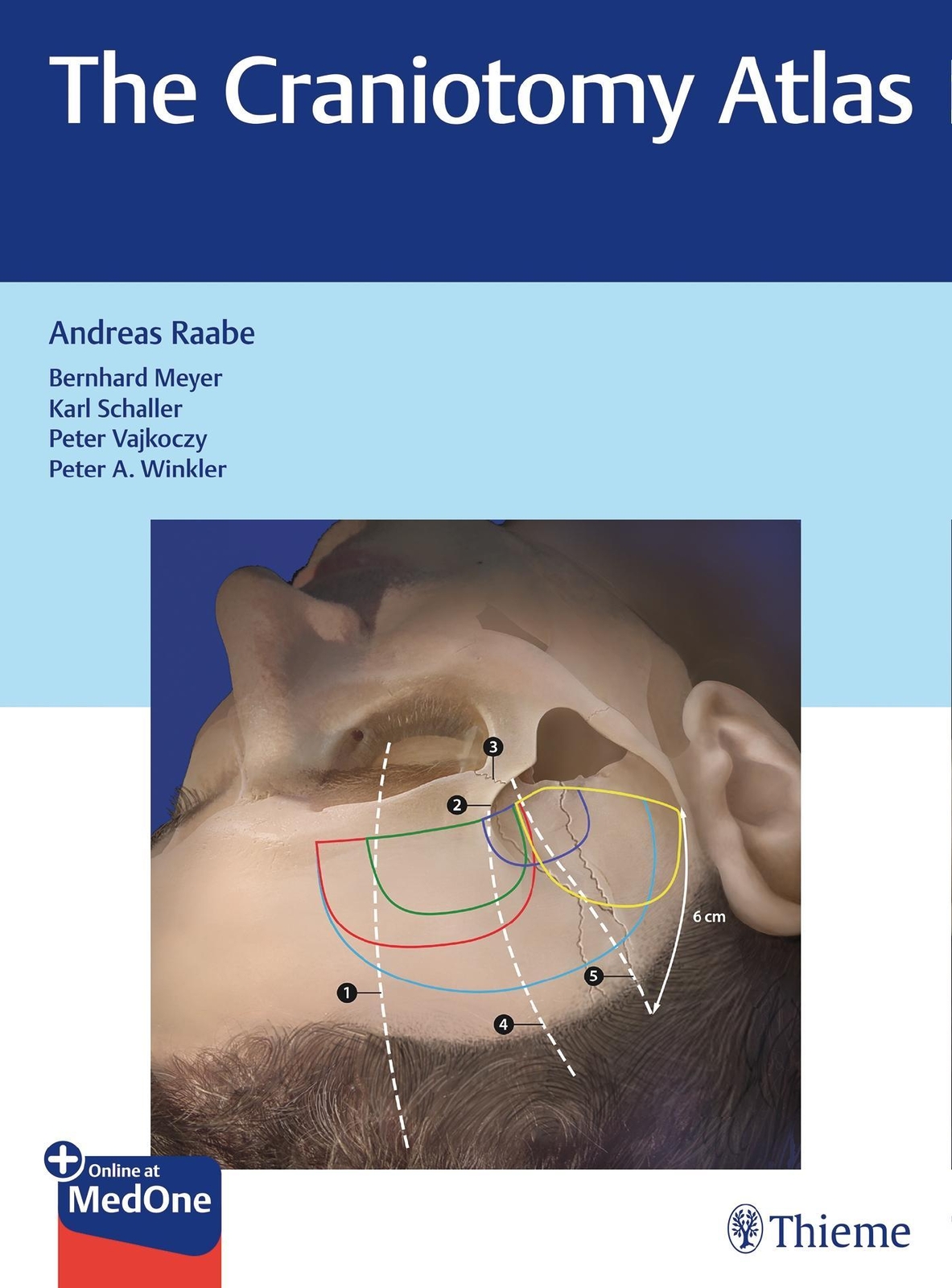 Thumbnail - The Craniotomy Atlas, Andreas Raabe