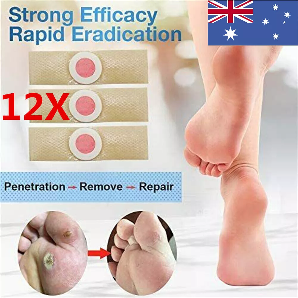 Callus remover deals pads
