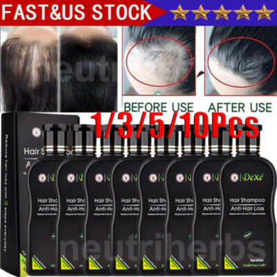 8/10x Dexe Original Anti Hair Loss Shampoo Natural Herbal Hair Growth Treatment