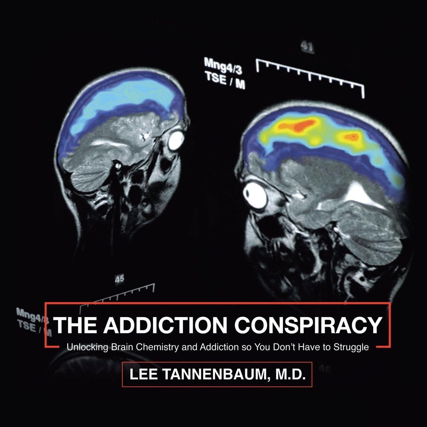 Thumbnail - Lee Tannenbaum M. D. | The Addiction Conspiracy | Taschenbuch |
