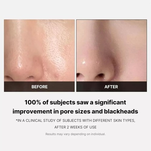 Medicube Peeling Pad - Zero Pore, Red Succins Acid Peeling ~ Super Ci9922 - Bild 5 von 21