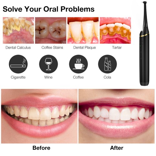 Powerful Ultrasonic Plaque Remover for Teeth with 5 Modes Dental Tooth Cleaner - Picture 18 of 25