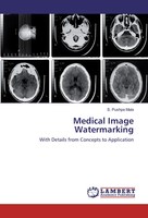 S. Pushpa Mala | Medical Image Watermarking | Taschenbuch | Englisch (2017)