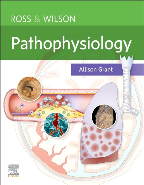 Ross & Wilson Pathophysiology by Allison, BSc PhD RGN  Grant (Paperback Book)