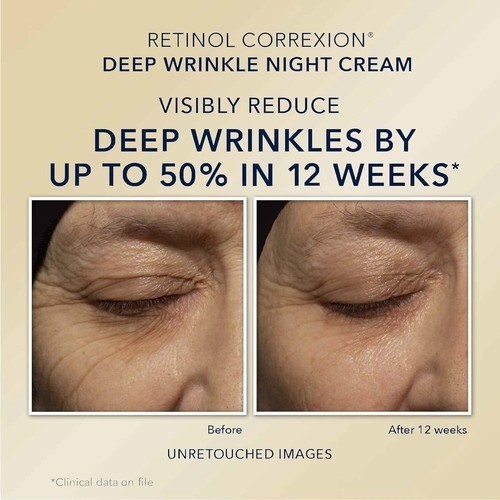 RoC Retinol Correxion Value Set Duo, Deep Wrinkle Night Face Cream + Eye Cream - Picture 17 of 18