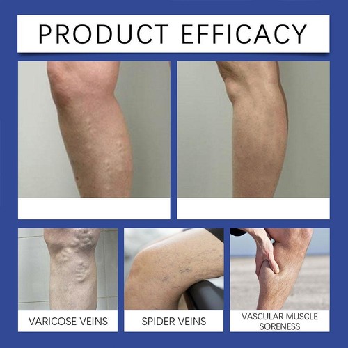 Leg Care Cream 100g - Edema Relief Soothing Massage Carea3d81324 - Picture 12 of 14