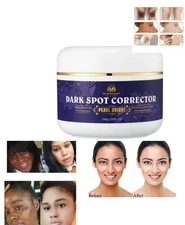 BloomLight Dark Spot Corrector – Skin Care Cream for Even Tone