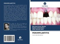 Periimplantitis Navneet Kour Mehta