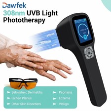 308nm Excimer UVB Phototherapy Lamp 49 Diodes Portable for Skin Treatment Home