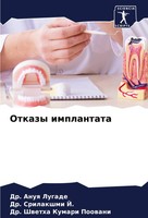 Anuq Lugade (U. A.) | Otkazy Implantata | Taschenbuch | Russisch (2024)