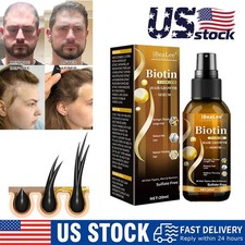 5x Biotin Hair Growth Spray Anti Hair Loss Fast Regrowth Scalp Treatment Serum