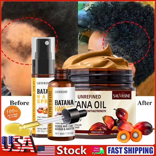 Natural Batana Oil Cream for Hair Growth Anti Hair Loss Treatment Men & Women