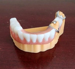LOWER PARTIAL DENTURE WAX-UP DEMONSTRATION MODEL 