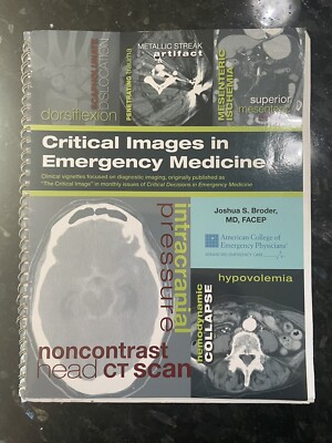 Critical Images in Emergency Medicine by Joshua Broder Spiral PB 2013