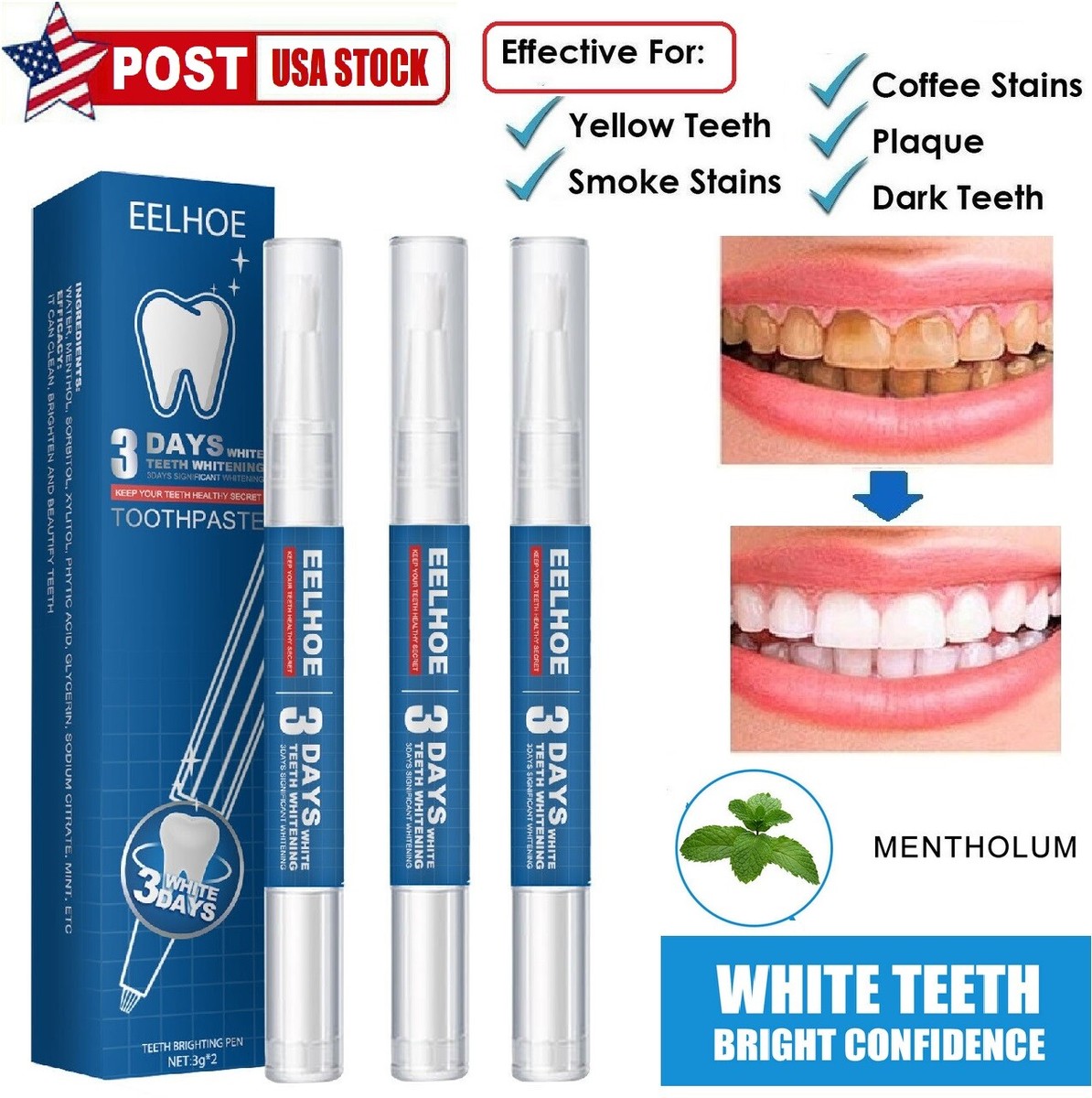 3 × Teeth Whitening Pen Tooth Stains Remover Teeth Whitening Gel