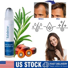 Be Bodywise Hair Growth Serum Roll-On 25ml - 3% Rosemary, Reduces Hair Fall