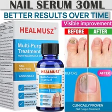 HEALMUSZ Antibacterial Fungal Nail Treatment Nail Repair Essential Oil Serum US